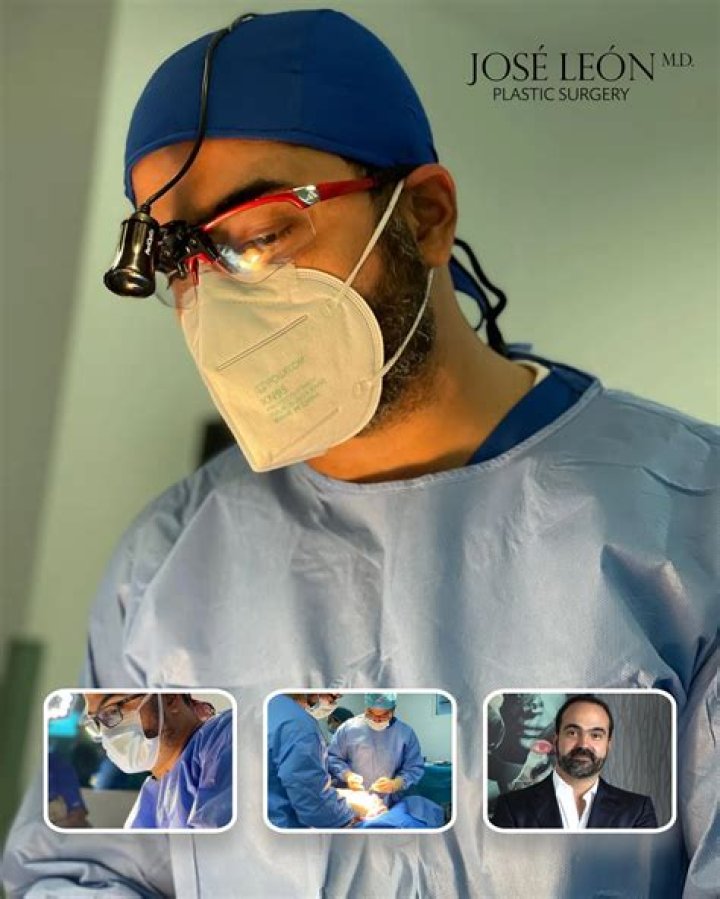 Dr Jose Desena Reviews {Oct} Know About Plastic Surgeon!
